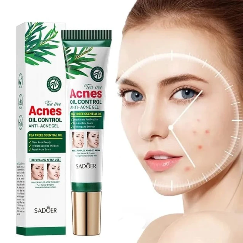 Anti-Acnes Gel